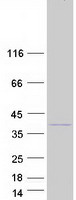 FAM49B / L1 Protein - Purified recombinant protein FAM49B was analyzed by SDS-PAGE gel and Coomassie Blue Staining