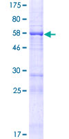 FAM53B Protein - 12.5% SDS-PAGE of human FAM53B stained with Coomassie Blue