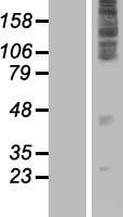 FAM57A / CT120 Protein - Western validation with an anti-DDK antibody * L: Control HEK293 lysate R: Over-expression lysate