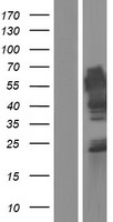 FAM63A Protein - Western validation with an anti-DDK antibody * L: Control HEK293 lysate R: Over-expression lysate