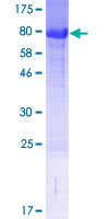 FAM63A Protein - 12.5% SDS-PAGE of human FAM63A stained with Coomassie Blue