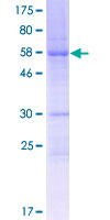 FAM64A Protein - 12.5% SDS-PAGE of human FAM64A stained with Coomassie Blue