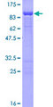 FAM65B / DIFF48 Protein - 12.5% SDS-PAGE of human C6orf32 stained with Coomassie Blue