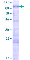 FAM71B Protein - 12.5% SDS-PAGE of human FAM71B stained with Coomassie Blue