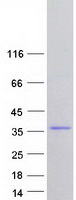 FAM76A Protein - Purified recombinant protein FAM76A was analyzed by SDS-PAGE gel and Coomassie Blue Staining