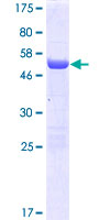 FAM78A Protein - 12.5% SDS-PAGE of human FAM78A stained with Coomassie Blue