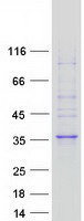 FAM78A Protein - Purified recombinant protein FAM78A was analyzed by SDS-PAGE gel and Coomassie Blue Staining