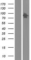 FAM83E Protein - Western validation with an anti-DDK antibody * L: Control HEK293 lysate R: Over-expression lysate