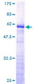 FAM84A Protein - 12.5% SDS-PAGE of human NSE1 stained with Coomassie Blue