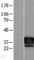 FAM84B Protein - Western validation with an anti-DDK antibody * L: Control HEK293 lysate R: Over-expression lysate