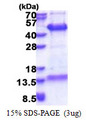 FAM84B Protein