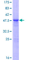 FAM89B Protein - 12.5% SDS-PAGE of human FAM89B stained with Coomassie Blue
