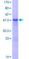 FAM89B Protein - 12.5% SDS-PAGE of human FAM89B stained with Coomassie Blue