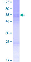 FAM92B Protein - 12.5% SDS-PAGE of human FAM92B stained with Coomassie Blue
