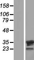 FAM9B Protein - Western validation with an anti-DDK antibody * L: Control HEK293 lysate R: Over-expression lysate