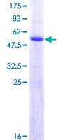 FAM9C Protein - 12.5% SDS-PAGE of human FAM9C stained with Coomassie Blue