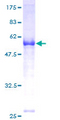 FANCA Protein - 12.5% SDS-PAGE of human FANCA stained with Coomassie Blue