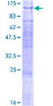 FANCB / FAB Protein - 12.5% SDS-PAGE of human FANCB stained with Coomassie Blue