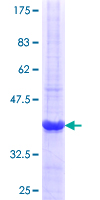 FANCB / FAB Protein - 12.5% SDS-PAGE Stained with Coomassie Blue.