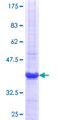 FANCB / FAB Protein - 12.5% SDS-PAGE Stained with Coomassie Blue.