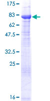 FANCC Protein - 12.5% SDS-PAGE of human FANCC stained with Coomassie Blue