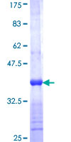 FANCC Protein - 12.5% SDS-PAGE Stained with Coomassie Blue.