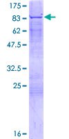 FANCE Protein - 12.5% SDS-PAGE of human FANCE stained with Coomassie Blue