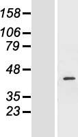 FANCF Protein - Western validation with an anti-DDK antibody * L: Control HEK293 lysate R: Over-expression lysate