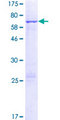 FANCF Protein - 12.5% SDS-PAGE of human FANCF stained with Coomassie Blue