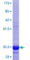 FANCF Protein - 12.5% SDS-PAGE Stained with Coomassie Blue.