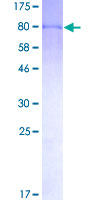 FANCG Protein - 12.5% SDS-PAGE of human FANCG stained with Coomassie Blue