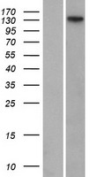 FANCI Protein - Western validation with an anti-DDK antibody * L: Control HEK293 lysate R: Over-expression lysate