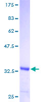 FANCI Protein - 12.5% SDS-PAGE of human FLJ10719 stained with Coomassie Blue