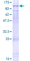 FANCM Protein - 12.5% SDS-PAGE of human FANCM stained with Coomassie Blue