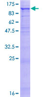 FAP Alpha Protein - 12.5% SDS-PAGE of human FAP stained with Coomassie Blue