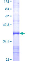 FAP Alpha Protein - 12.5% SDS-PAGE Stained with Coomassie Blue.