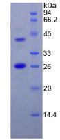 FAP Alpha Protein - Recombinant Fibroblast Activation Protein Alpha By SDS-PAGE