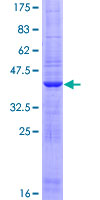 FARP1 / CDEP Protein - 12.5% SDS-PAGE of human FARP1 stained with Coomassie Blue