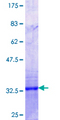 FARP1 / CDEP Protein - 12.5% SDS-PAGE Stained with Coomassie Blue.