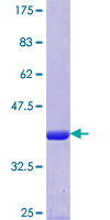 FARS2 Protein - 12.5% SDS-PAGE Stained with Coomassie Blue.