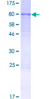 FARSA Protein - 12.5% SDS-PAGE of human FARSA stained with Coomassie Blue