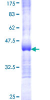 FARSA Protein - 12.5% SDS-PAGE Stained with Coomassie Blue.