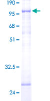 FARSB Protein - 12.5% SDS-PAGE of human FARSLB stained with Coomassie Blue