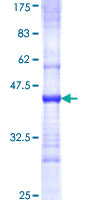 FARSB Protein - 12.5% SDS-PAGE Stained with Coomassie Blue.