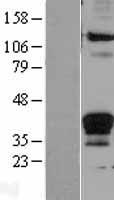 FASLG / Fas Ligand Protein - Western validation with an anti-DDK antibody * L: Control HEK293 lysate R: Over-expression lysate