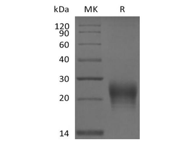 FASLG / Fas Ligand Protein - Recombinant Human Fas Ligand / TNFSF6 (N-6His)