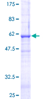FASLG / Fas Ligand Protein - 12.5% SDS-PAGE of human FASLG stained with Coomassie Blue