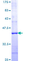 FASLG / Fas Ligand Protein - 12.5% SDS-PAGE Stained with Coomassie Blue.