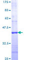 FASLG / Fas Ligand Protein - 12.5% SDS-PAGE Stained with Coomassie Blue.