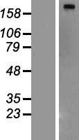 FASN / Fatty Acid Synthase Protein - Western validation with an anti-DDK antibody * L: Control HEK293 lysate R: Over-expression lysate